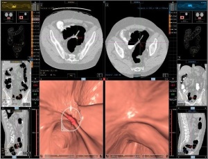 fig.4