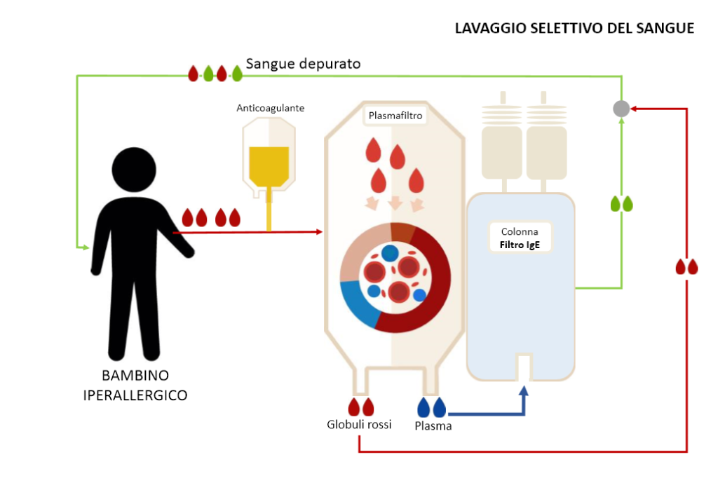 infografica-plasmaferesi-IgE