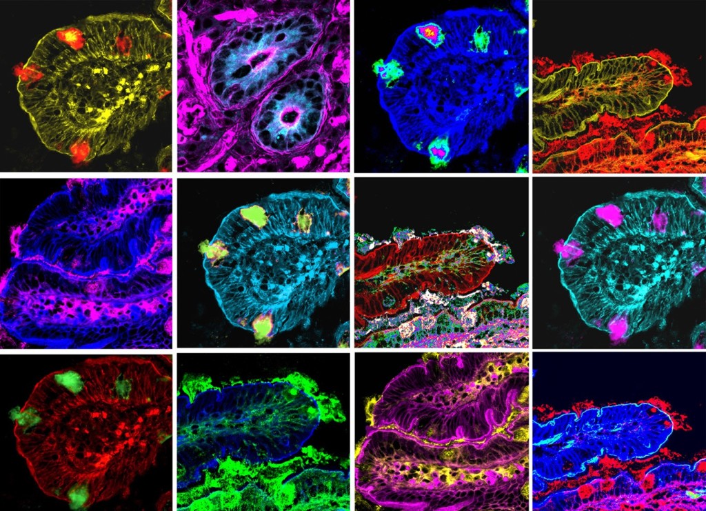 villi-intestinali-confocale-bambino-gesu