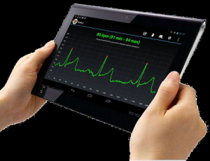 elettrocardiografi-indossabili-politecnico-di-torino-4