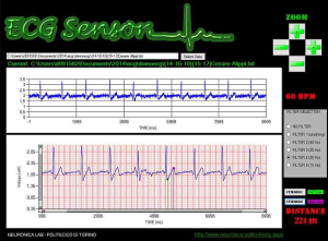 elettrocardiografi-indossabili-politecnico-di-torino-5