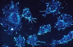 cellule-tumorali