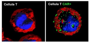 cellule-car-t-opbg