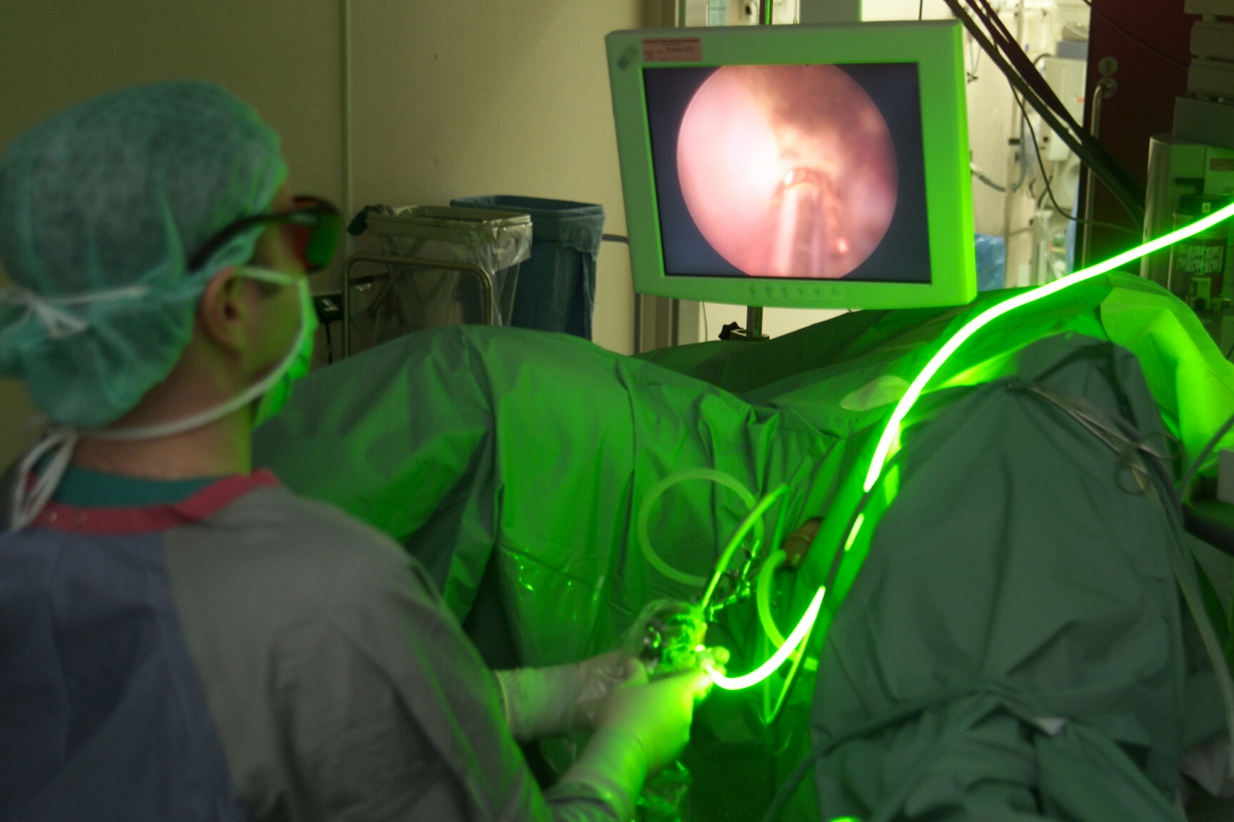 intervento prostata laser