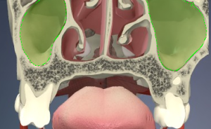 fig. 6_seni mascellari e loro rapporto con le cavità nasali