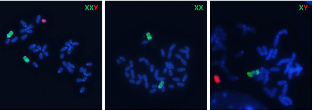 trapianto-di-cromosoma1-cnr
