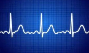 cuore-elettrocardiogramma