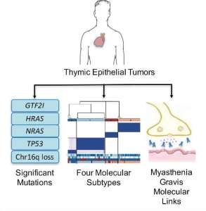 thymic-epithelial-tumors