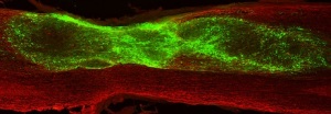 trapianto-cellule-staminali-neuroepiteliali