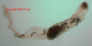 echinococcus-esemplare-adulto