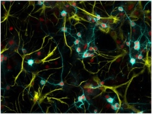 neuroni-e-astrociti-san-raffaele
