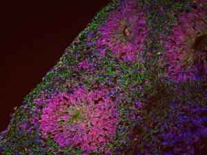 organoide-cerebrale-ieo-uni-milano